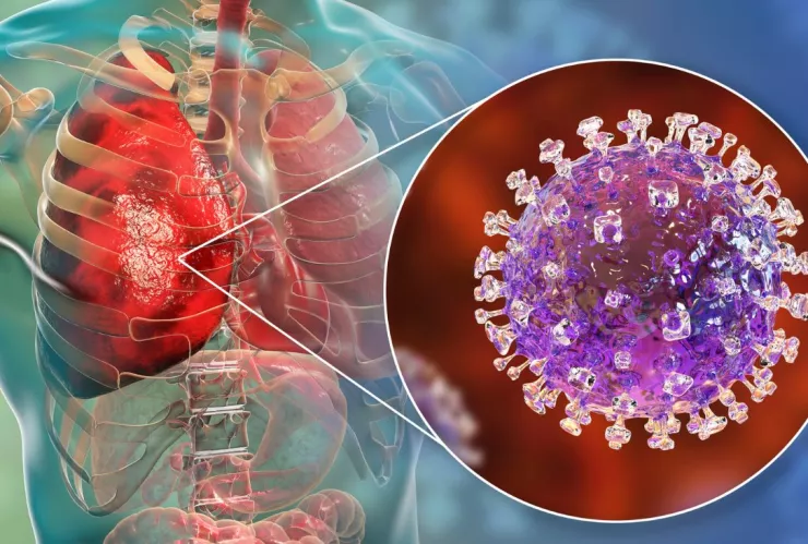 Image - Regios Al Cuadrado Virus-nipah-oms-covid-19